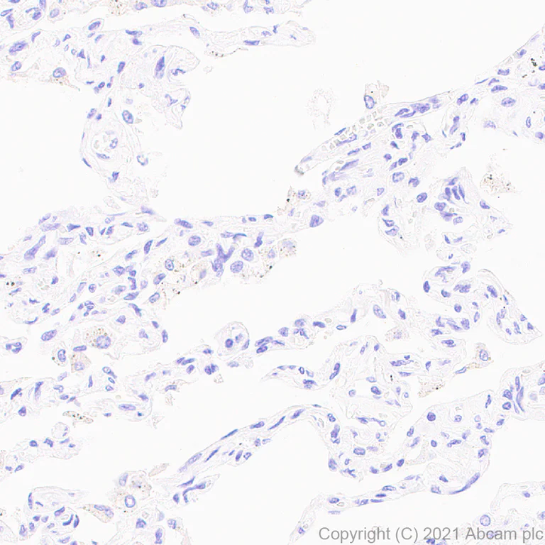 Immunohistochemistry (Formalin/PFA-fixed paraffin-embedded sections) - Anti-Titin antibody [EPR24455-21] (AB284860)