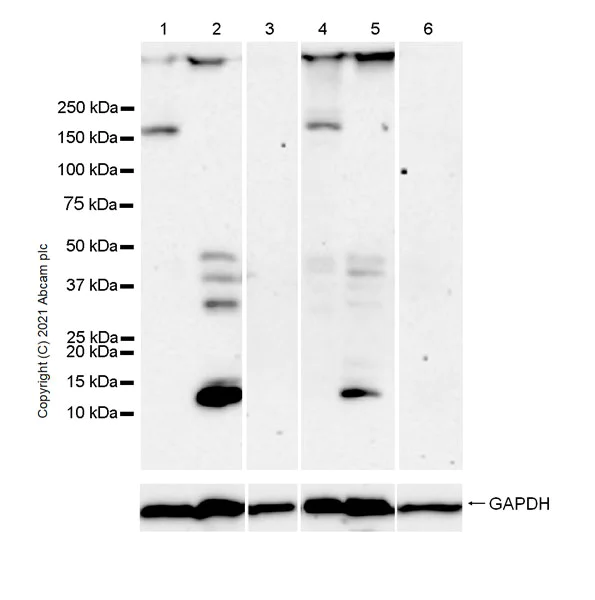 Western blot - Anti-Titin antibody [EPR24455-21] (AB284860)