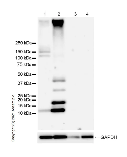 Western blot - Anti-Titin antibody [EPR24455-21] - BSA and Azide free (AB284862)