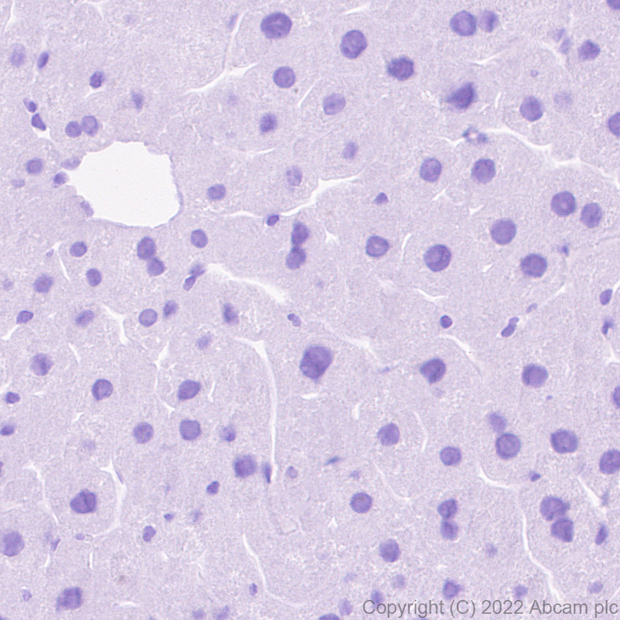 Immunohistochemistry (Formalin/PFA-fixed paraffin-embedded sections) - Anti-Titin antibody [EPR26167-75] - BSA and Azide free (AB307447), expandable thumbnail