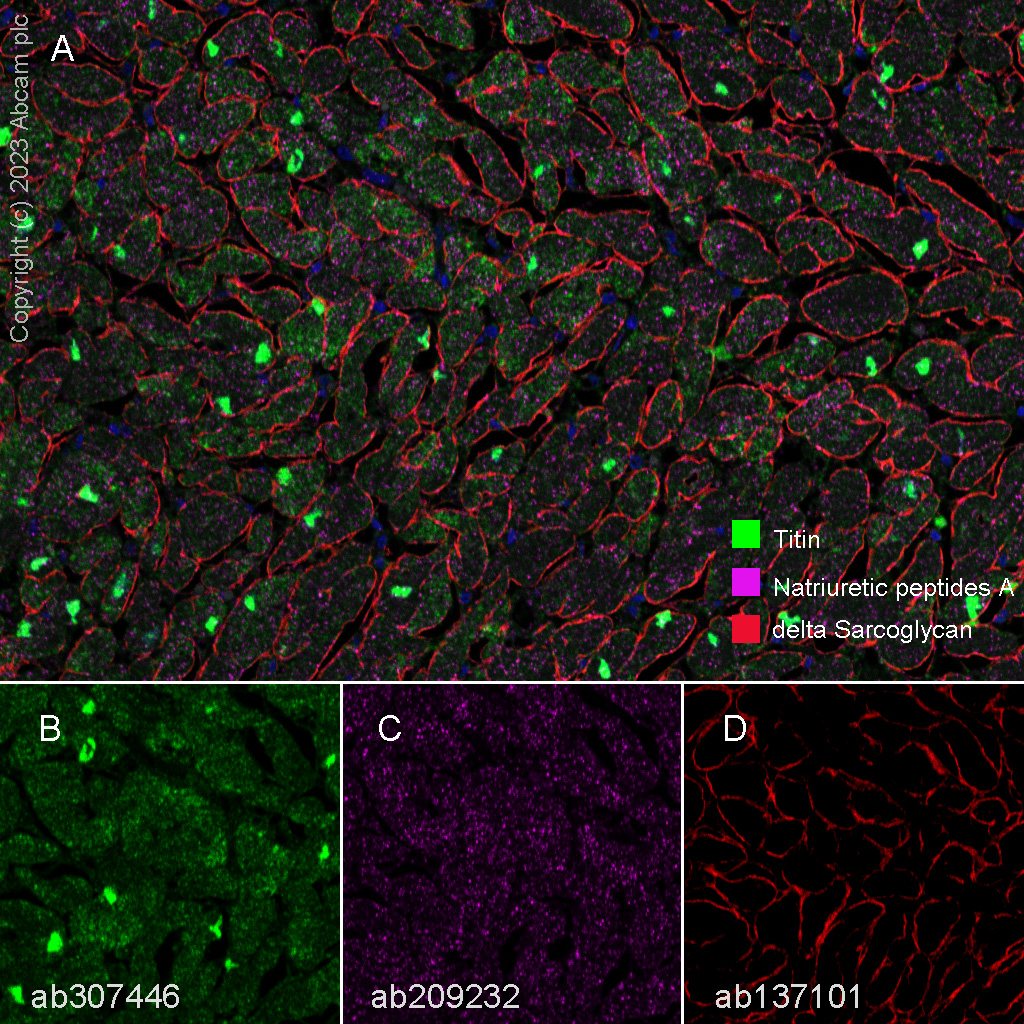 Multiplex immunohistochemistry - Anti-Titin antibody [EPR26167-75] - BSA and Azide free (AB307447), expandable thumbnail