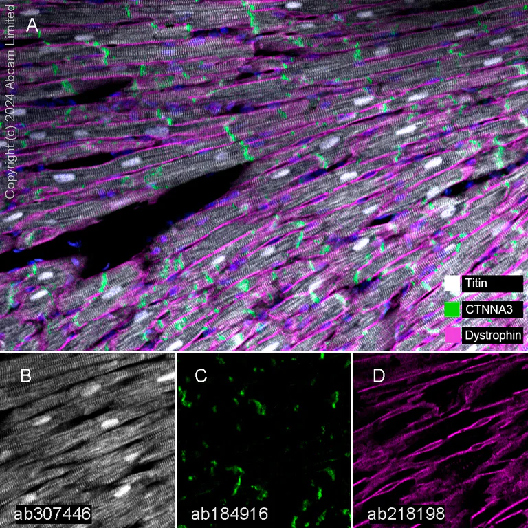 Multiplex immunohistochemistry - Anti-Titin antibody [EPR26167-75] - BSA and Azide free (AB307447)