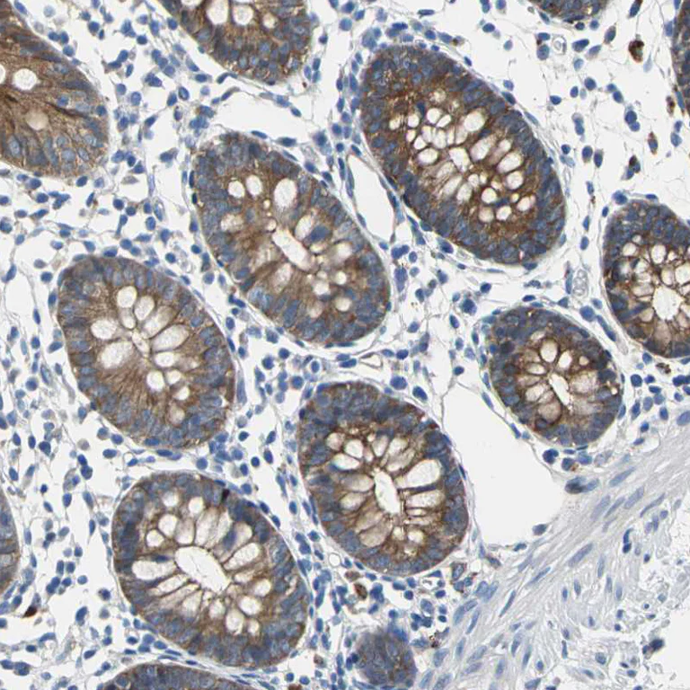 Immunohistochemistry (Formalin/PFA-fixed paraffin-embedded sections) - Anti-TJP2/ZO2 antibody (AB224314)