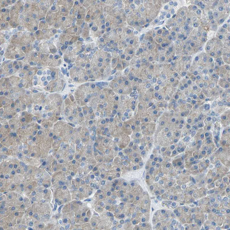 Immunohistochemistry (Formalin/PFA-fixed paraffin-embedded sections) - Anti-TJP2/ZO2 antibody (AB224314)