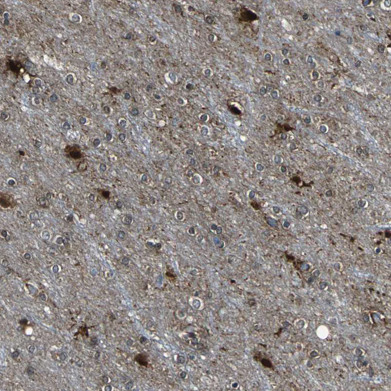 Immunohistochemistry (Formalin/PFA-fixed paraffin-embedded sections) - Anti-TJP2/ZO2 antibody (AB224314)