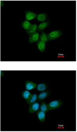 Immunocytochemistry/ Immunofluorescence - Anti-TKTL1/TKR antibody (AB155662)
