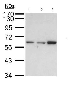 Western blot - Anti-TKTL1/TKR antibody (AB155662)