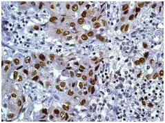Immunohistochemistry (Formalin/PFA-fixed paraffin-embedded sections) - Anti-TKTL2 antibody [EPR8592] (AB131331)