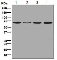 Western blot - Anti-TKTL2 antibody [EPR8592] (AB131331)