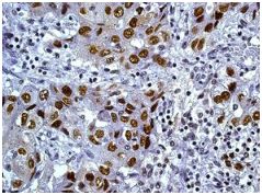 Immunohistochemistry (Formalin/PFA-fixed paraffin-embedded sections) - Anti-TKTL2 antibody [EPR8592] - BSA and Azide free (AB248410)