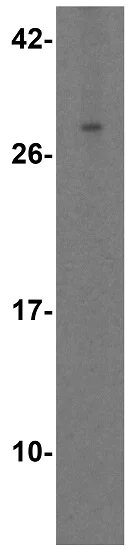 Western blot - Anti-TL1A antibody (AB37169)