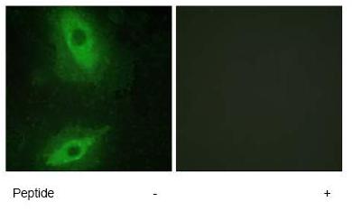Immunocytochemistry/ Immunofluorescence - Anti-TL1A antibody (AB64986)