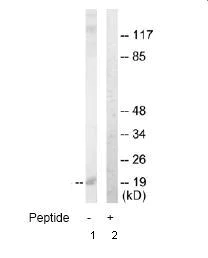 Western blot - Anti-TL1A antibody (AB64986)