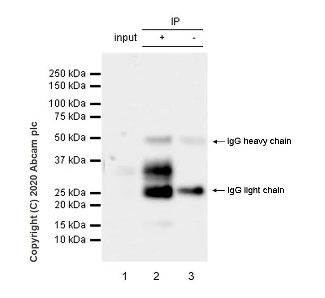 Immunoprecipitation - Anti-TL1A antibody [EPR23330-2] (AB270456)