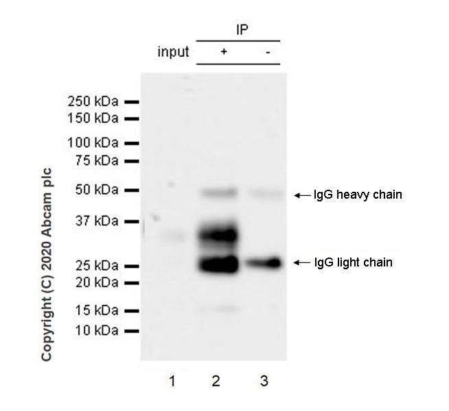 Immunoprecipitation - Anti-TL1A antibody [EPR23330-2] - BSA and Azide free (AB272051)