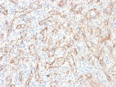 Immunohistochemistry (Formalin/PFA-fixed paraffin-embedded sections) - Anti-TL1A antibody [rVEGI/1283] - BSA and Azide free (AB236324)