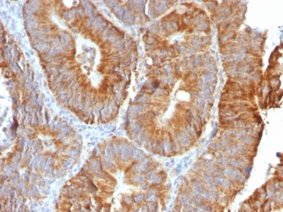 Immunohistochemistry (Formalin/PFA-fixed paraffin-embedded sections) - Anti-TL1A antibody [VEGI/2052R] (AB234307)