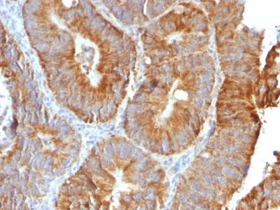 Immunohistochemistry (Formalin/PFA-fixed paraffin-embedded sections) - Anti-TL1A antibody [VEGI/2052R] (AB234307)
