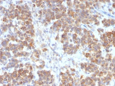 Immunohistochemistry (Formalin/PFA-fixed paraffin-embedded sections) - Anti-TL1A antibody [VEGI/2052R] (AB234307)