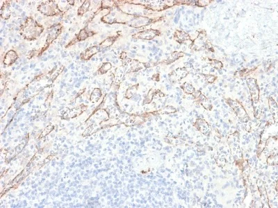 Immunohistochemistry (Formalin/PFA-fixed paraffin-embedded sections) - Anti-TL1A antibody [VEGI/2052R] (AB234307)