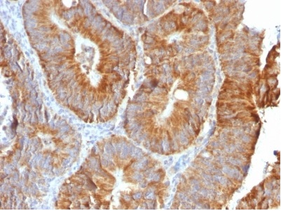 Immunohistochemistry (Formalin/PFA-fixed paraffin-embedded sections) - Anti-TL1A antibody [VEGI/2052R] - BSA and Azide free (AB236303), expandable thumbnail
