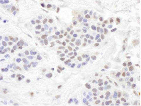 Immunohistochemistry (Formalin/PFA-fixed paraffin-embedded sections) - Anti-TLE 1 antibody (AB125183)