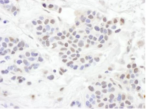Immunohistochemistry (Formalin/PFA-fixed paraffin-embedded sections) - Anti-TLE 1 antibody (AB125183)
