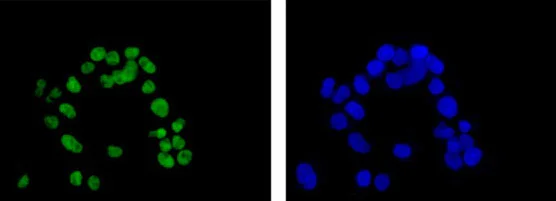 Immunocytochemistry/ Immunofluorescence - Anti-TLE 1 antibody [EPR9386(2)] (AB183742)