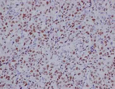 Immunohistochemistry (Formalin/PFA-fixed paraffin-embedded sections) - Anti-TLE 1 antibody [EPR9386(2)] (ab183742), expandable thumbnail