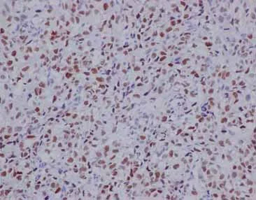 Immunohistochemistry (Formalin/PFA-fixed paraffin-embedded sections) - Anti-TLE 1 antibody [EPR9386(2)] (AB183742)