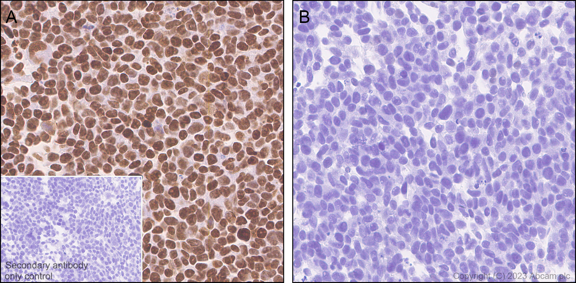 Immunohistochemistry (Formalin/PFA-fixed paraffin-embedded sections) - Anti-TLE 1 antibody [EPR9386(2)] (ab183742), expandable thumbnail