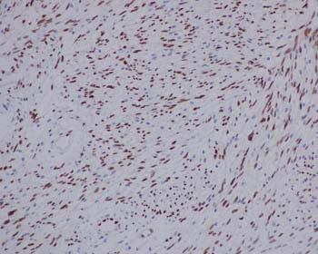 Immunohistochemistry (Formalin/PFA-fixed paraffin-embedded sections) - Anti-TLE 1 antibody [EPR9386(2)] (ab183742), expandable thumbnail