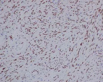 Immunohistochemistry (Formalin/PFA-fixed paraffin-embedded sections) - Anti-TLE 1 antibody [EPR9386(2)] (AB183742)