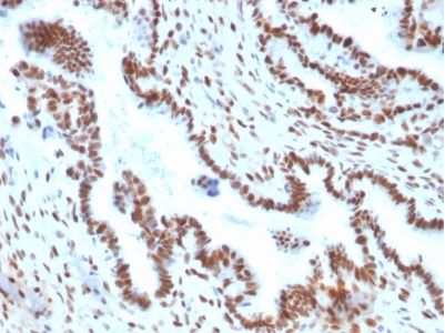 Immunohistochemistry (Formalin/PFA-fixed paraffin-embedded sections) - Anti-TLE 1 antibody [TLE1/2051] (AB238063)