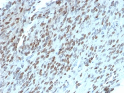 Immunohistochemistry (Formalin/PFA-fixed paraffin-embedded sections) - Anti-TLE 1 antibody [TLE1/2062] (AB238064), expandable thumbnail