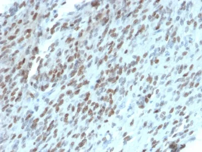 Immunohistochemistry (Formalin/PFA-fixed paraffin-embedded sections) - Anti-TLE 1 antibody [TLE1/2062] (AB238064)