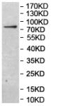 Western blot - Anti-TLE2 antibody (AB206147)