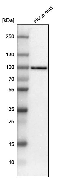 Western blot - Anti-TLE3/ESG antibody (AB185508)