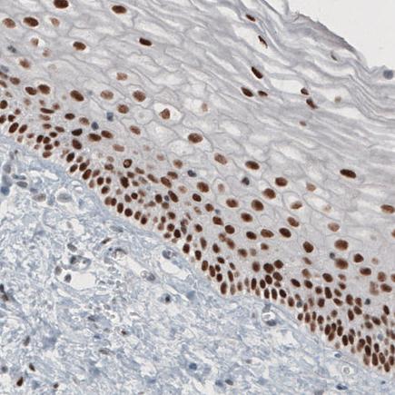 Immunohistochemistry (Formalin/PFA-fixed paraffin-embedded sections) - Anti-TLE3/ESG antibody [CL3573] (AB213596), expandable thumbnail