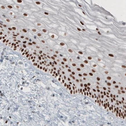 Immunohistochemistry (Formalin/PFA-fixed paraffin-embedded sections) - Anti-TLE3/ESG antibody [CL3573] (AB213596)