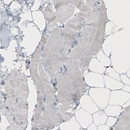 Immunohistochemistry (Formalin/PFA-fixed paraffin-embedded sections) - Anti-TLE3/ESG antibody [CL3573] (ab213596), expandable thumbnail