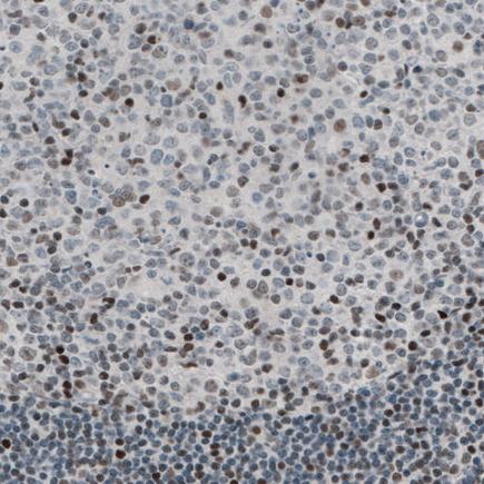 Immunohistochemistry (Formalin/PFA-fixed paraffin-embedded sections) - Anti-TLE3/ESG antibody [CL3573] (AB213596), expandable thumbnail