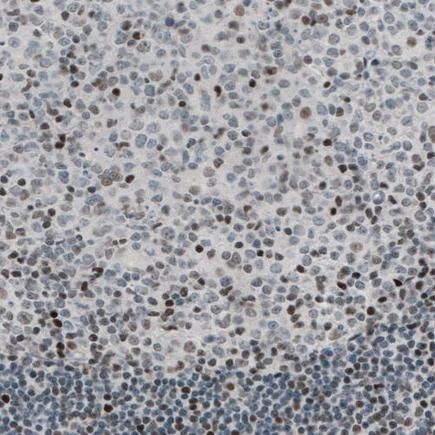 Immunohistochemistry (Formalin/PFA-fixed paraffin-embedded sections) - Anti-TLE3/ESG antibody [CL3573] (AB213596)