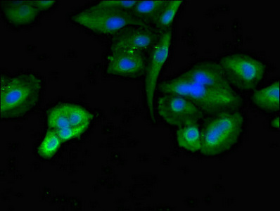 Immunocytochemistry/ Immunofluorescence - Anti-TLK2 antibody (AB224729)