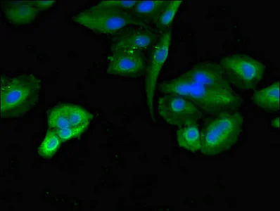 Immunocytochemistry/ Immunofluorescence - Anti-TLK2 antibody (AB224729)