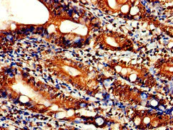 Immunohistochemistry (Formalin/PFA-fixed paraffin-embedded sections) - Anti-TLK2 antibody (AB224729)