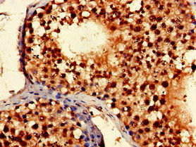 Immunohistochemistry (Formalin/PFA-fixed paraffin-embedded sections) - Anti-TLK2 antibody (AB224729)