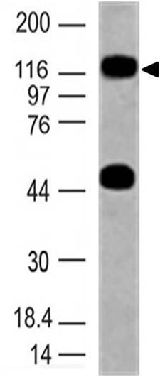 Western blot - Anti-TLR10 antibody [ABM3C85] (AB228511)