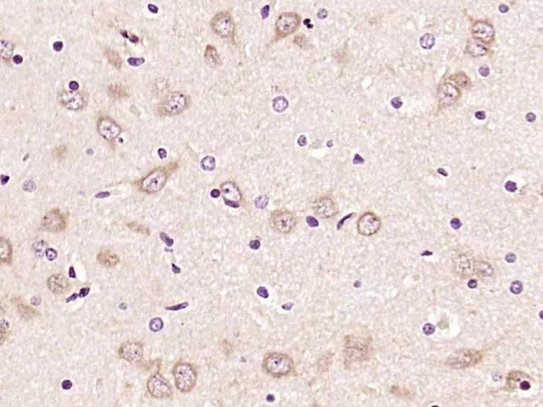 Immunohistochemistry (Formalin/PFA-fixed paraffin-embedded sections) - Anti-TLR2 antibody (AB213676)