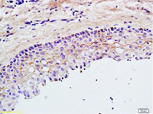 Immunohistochemistry (Formalin/PFA-fixed paraffin-embedded sections) - Anti-TLR2 antibody (AB213676)